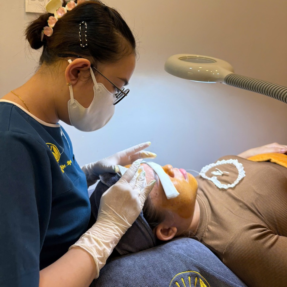 Bao Lâu Nên Lấy Nhân Mụn Một Lần