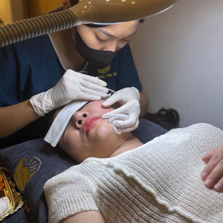 Những Điều Cần Chuẩn Bị Trước Khi Lấy Nhân Mụn